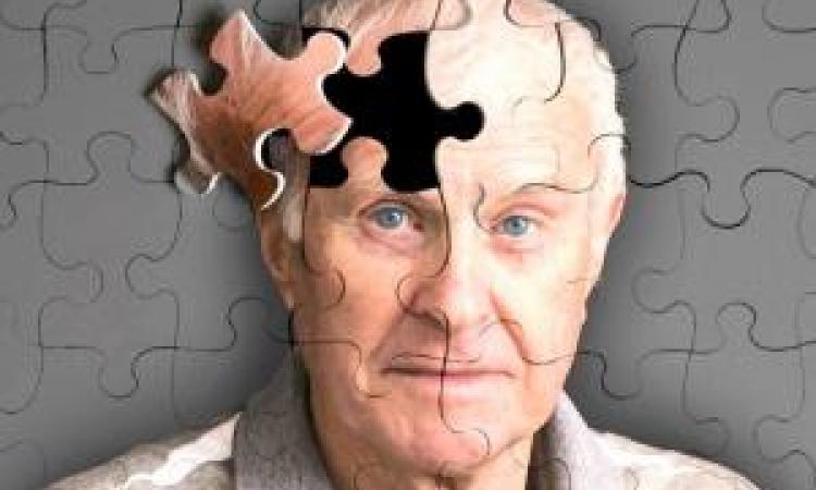 Scienza della vita: la Malattia di Alzheimer